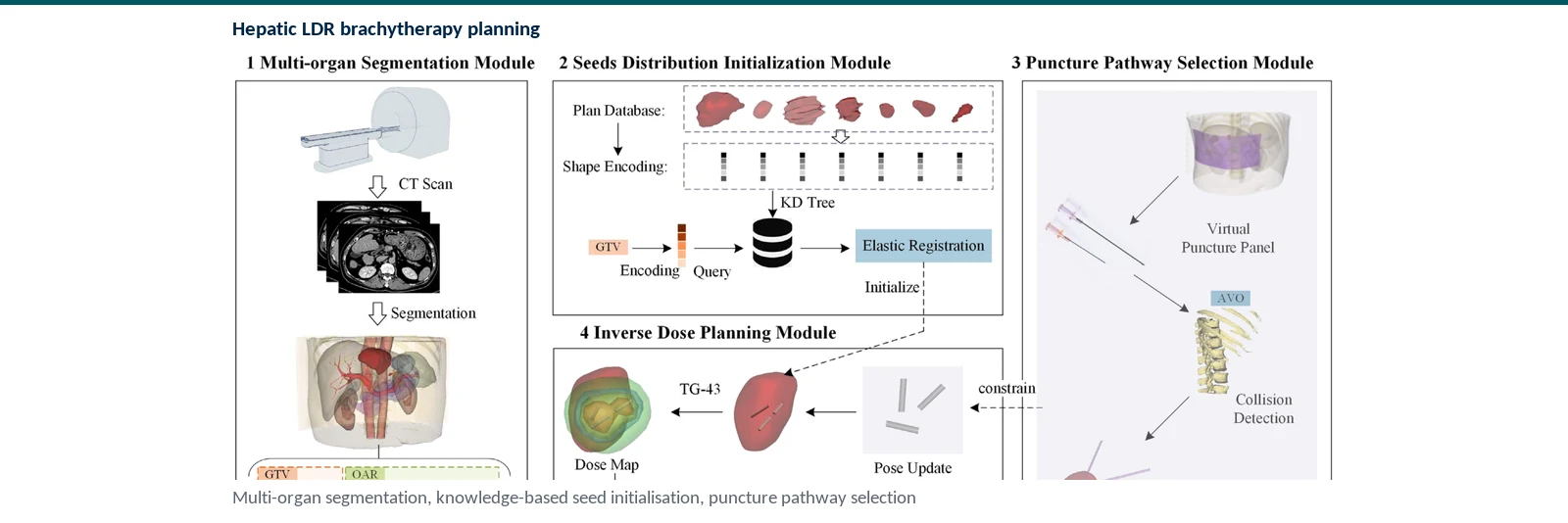 Graphical abstract of expertise-guided brachytherapy planning, from multi-organ CT segmentation and knowledge retrieval to seed initialization and inverse dose planning