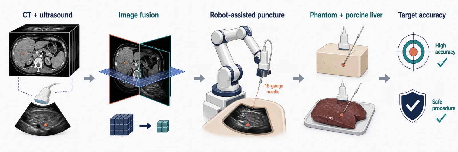 Graphical abstract of CT and ultrasound fusion guidance for robotic abdominal puncture in phantom and porcine liver models