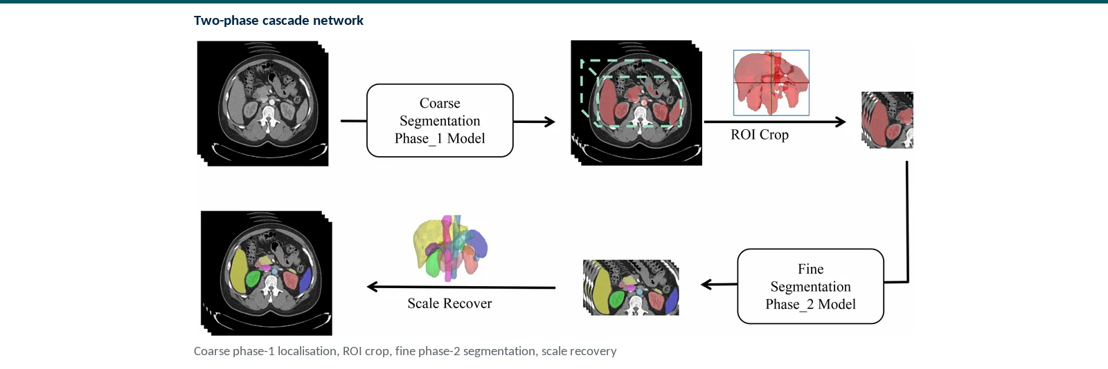 Graphical abstract of the two-phase scale-aware and self-attentive abdominal organ and pan-cancer segmentation pipeline