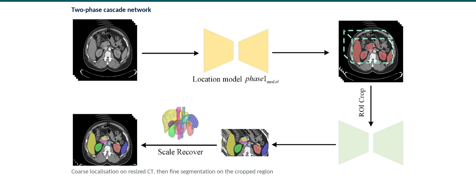 Graphical abstract of the two-phase lightweight abdominal multi-organ segmentation pipeline designed for laptop inference