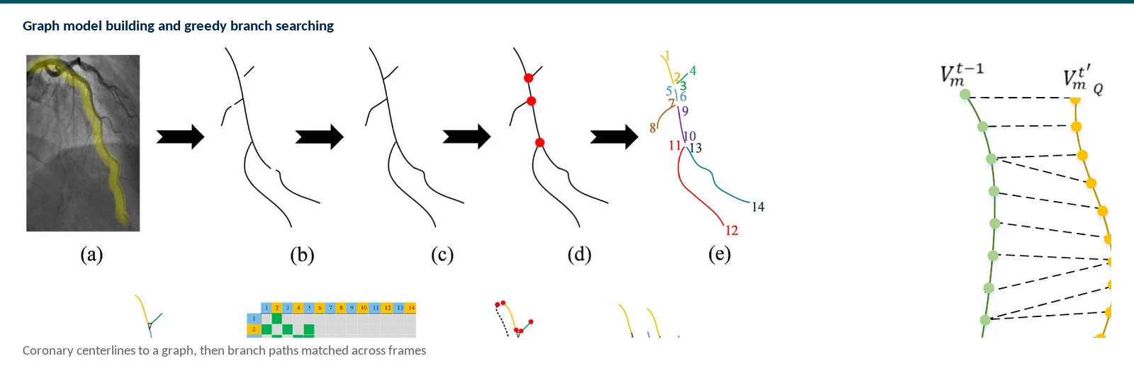 Graphical abstract of greedy graph search and soft batch matching for deformable vascular tracking across coronary angiograms