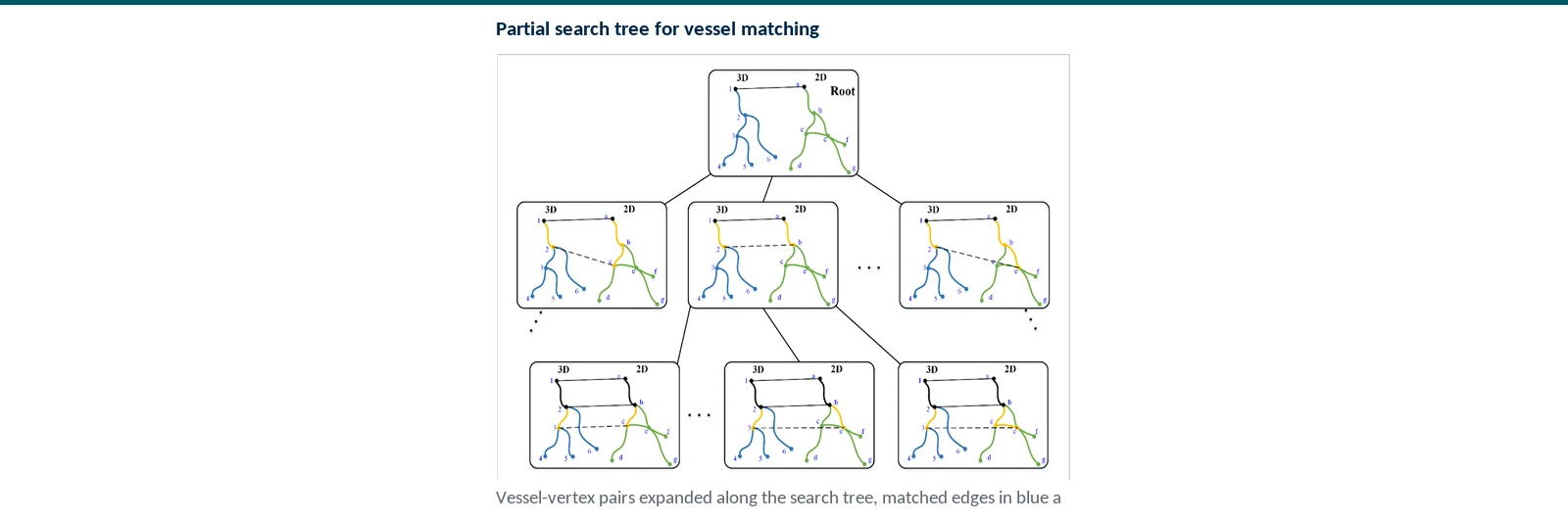 Graphical abstract of heuristic tree search for pose-independent rigid registration between 3D CTA and 2D X-ray vessel structures