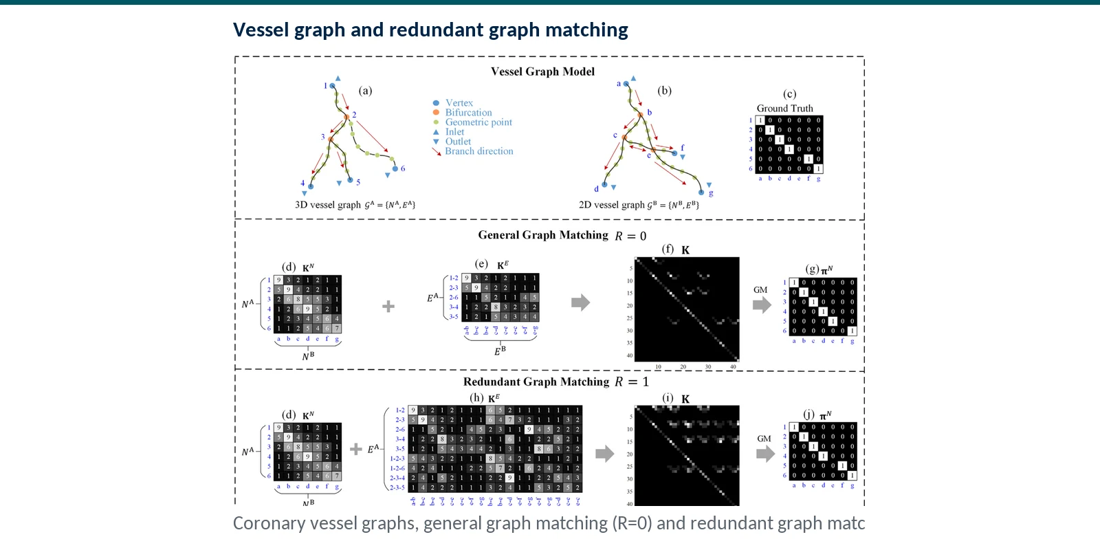 Graphical abstract of iterative closest graph matching for non-rigid 3D and 2D coronary artery registration