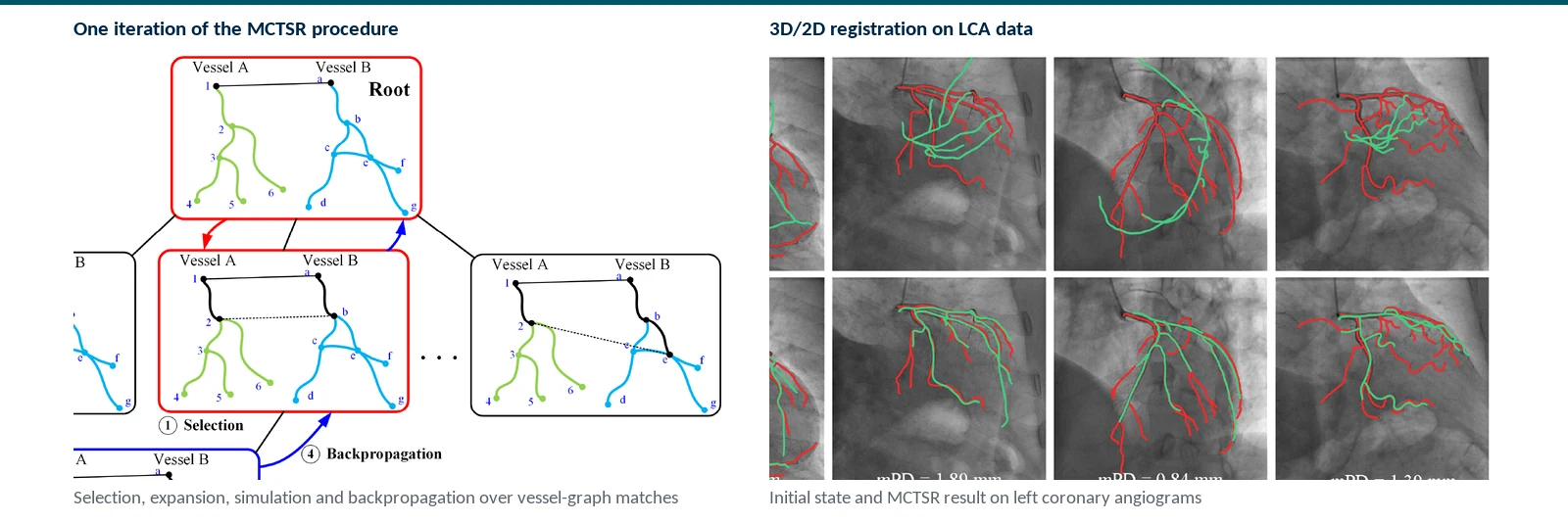 Graphical abstract of Monte Carlo tree search for pose-independent matching and rigid registration between 3D and 2D vessel graphs