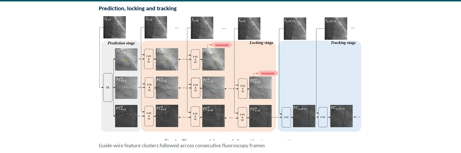 Graphical abstract of prediction, locking, tracking, and fold-back safety monitoring for a guidewire tip in robotic cardiovascular intervention
