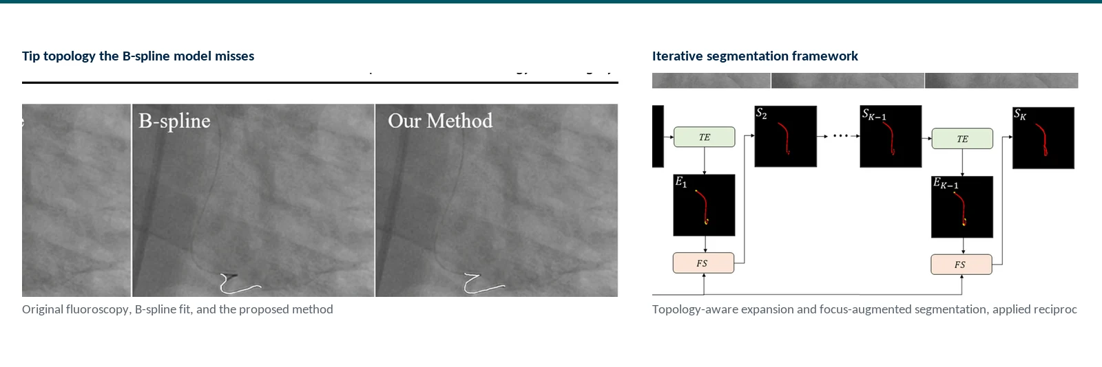 Graphical abstract of PixelTopoIS iterative guidewire segmentation with coupled pixel and topology loss, endpoint localization, and loop detection