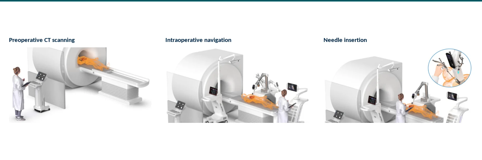 Graphical abstract reviewing registration, navigation, puncture guidance, respiratory compensation, and motion control in thoracoabdominal puncture robots