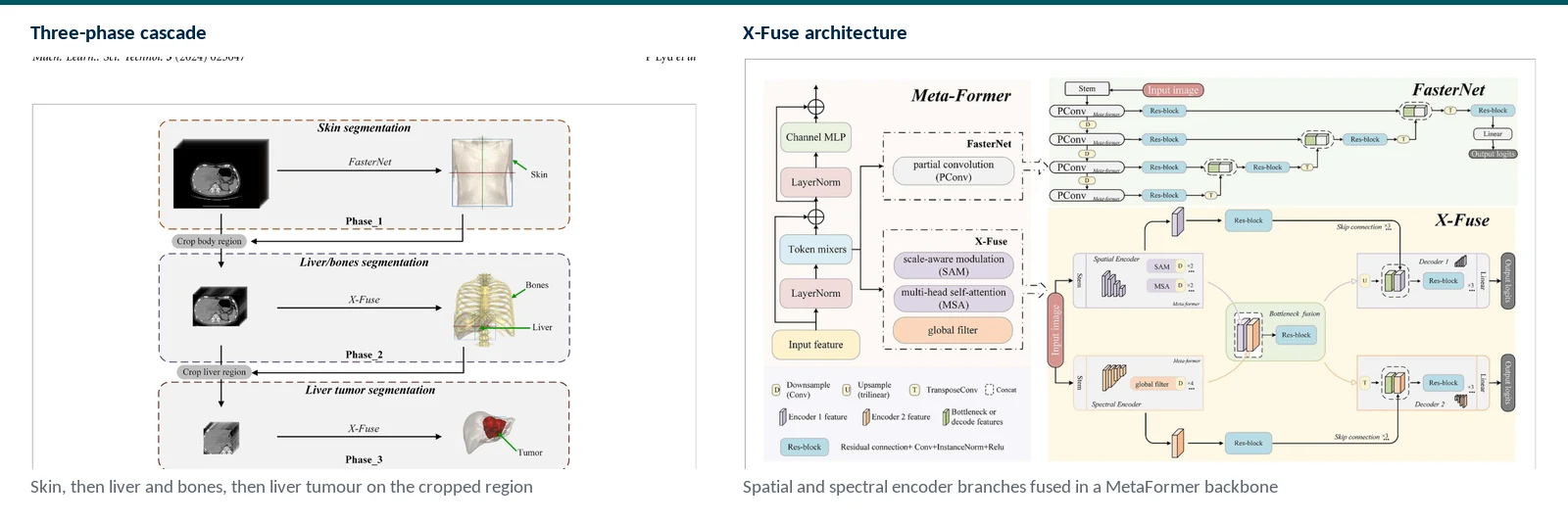 Graphical abstract of X-Fuse semi-supervised abdominal organ and liver tumor segmentation with spatial-frequency encoding and uncertainty rectification